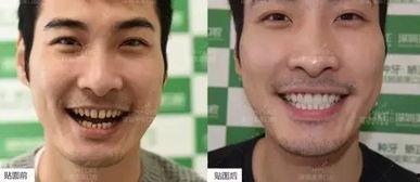 传媒吃瓜,揭秘娱乐圈幕后真相